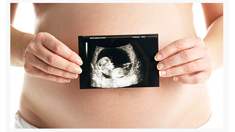 Cuarto mes de embarazo